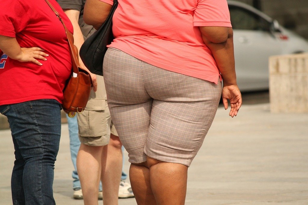 image Over 70% in north overweight or obese
