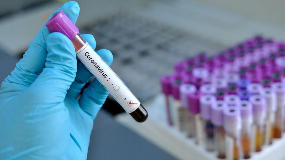 image Coronavirus: testing locations for Friday