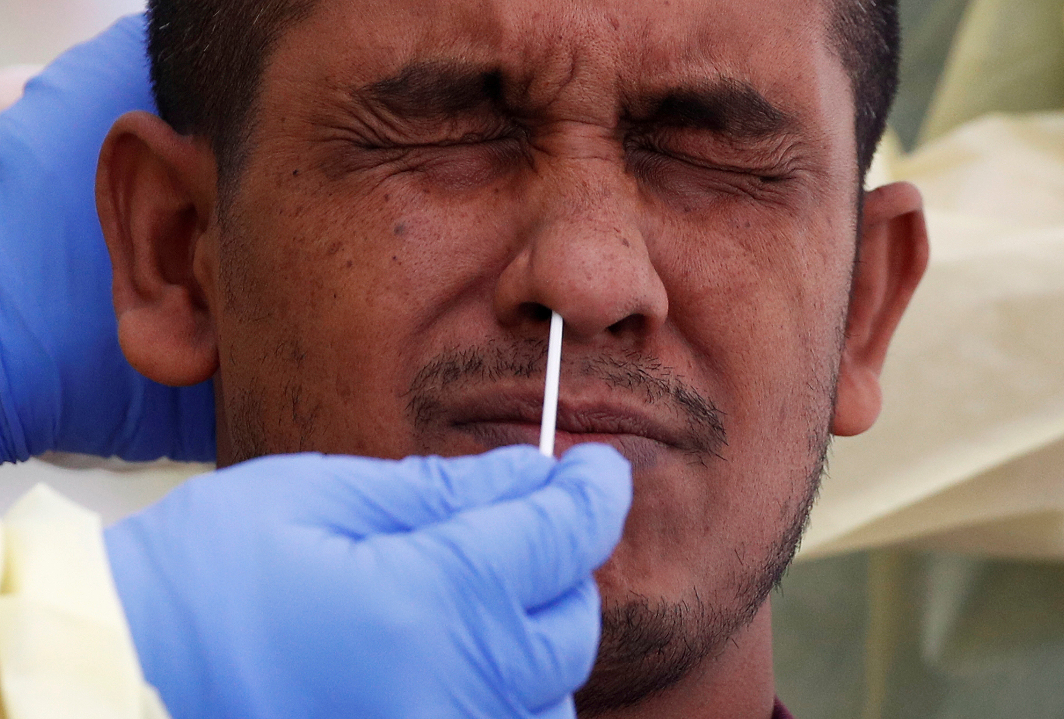 image Union calls for suspension of rapid testing after toxic substance found