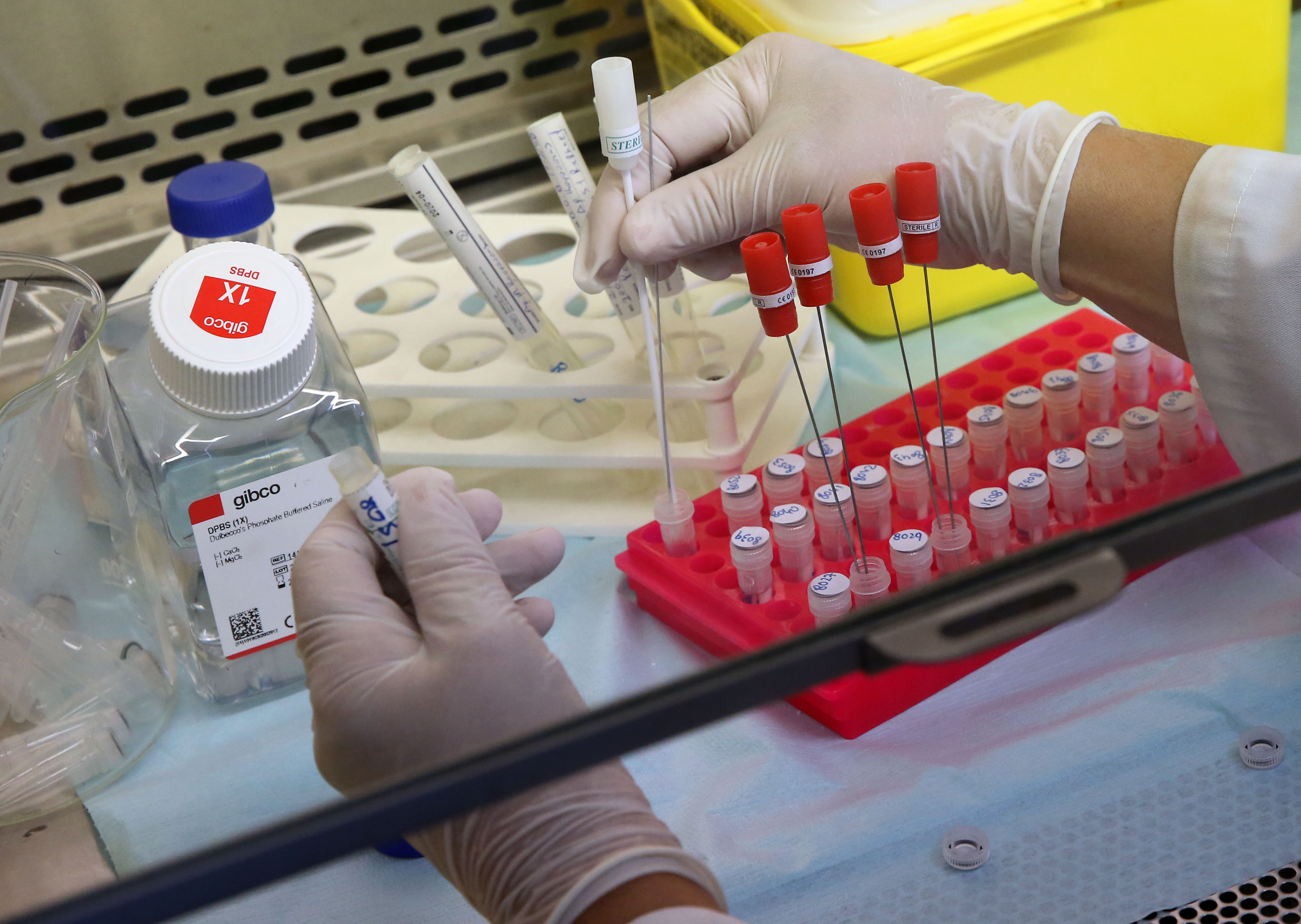 image Coronavirus: north counts 47 new cases