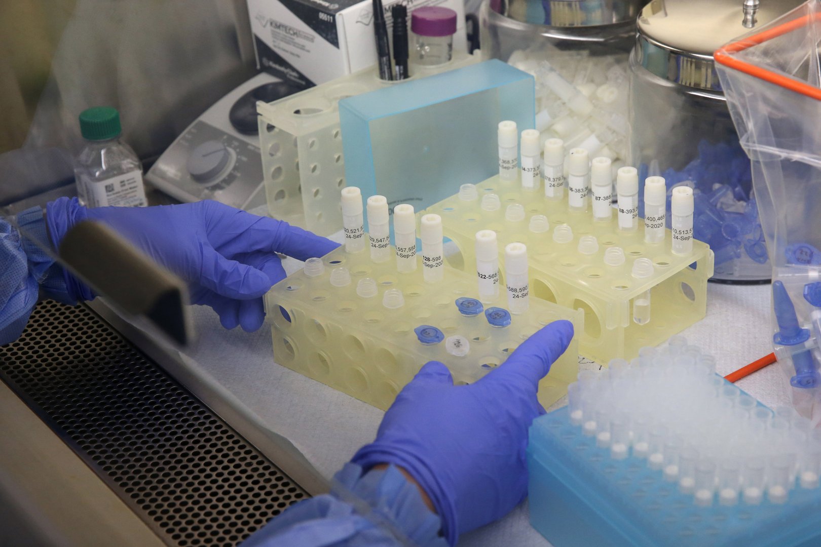 image Are PCR tests showing too many false positives?