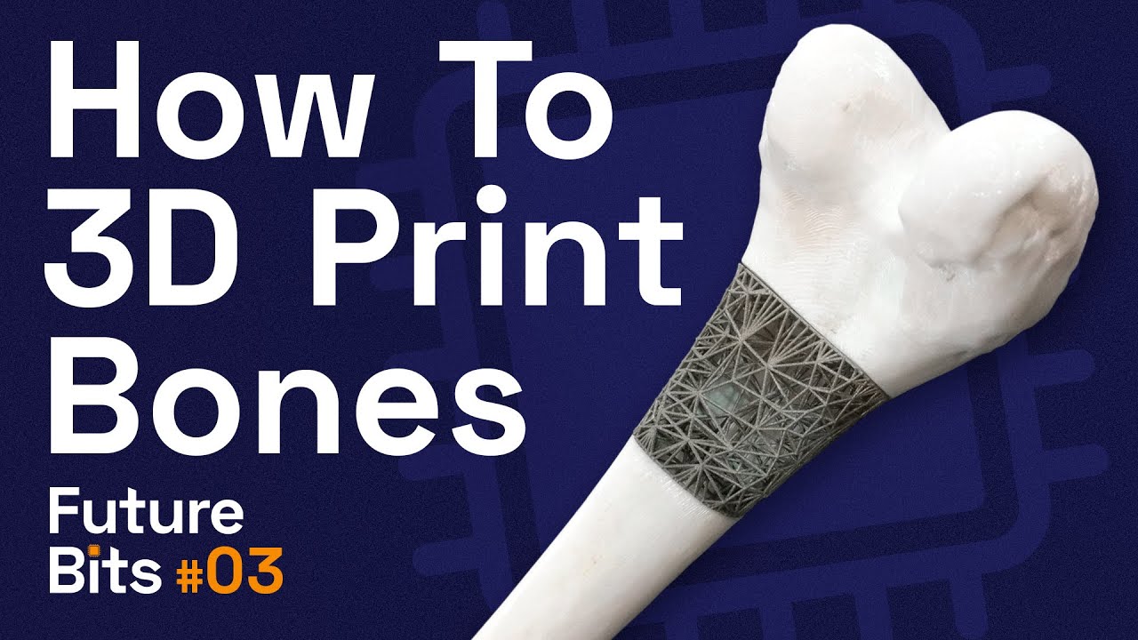 image How close are we to viable 3D bone printing?