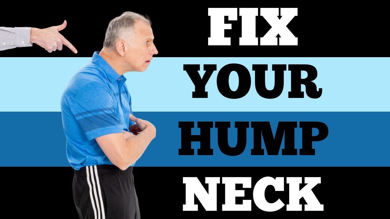 image The most effective exercises to correct &#8216;neck hump&#8217;