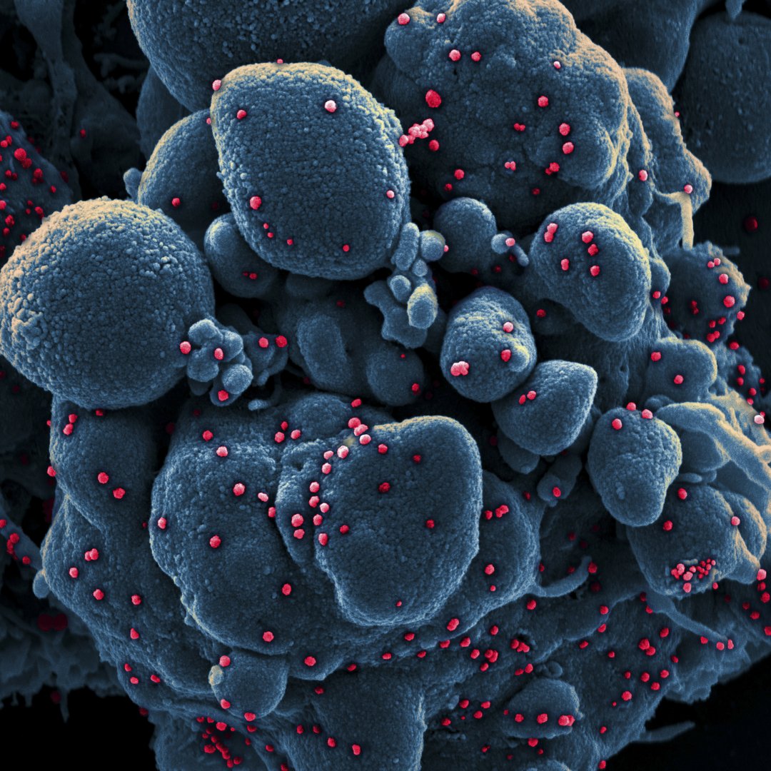 image UK Covid-19 variant is far more deadly than previous strains