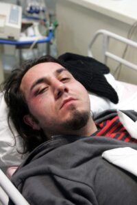 feature george marcos papageorgiou, one of the victims, in hospital after being beaten by police on december 20, 2005