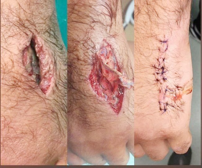 image Fish tanks, lions, chainsaws and pucks &#8211; freak injuries in sport