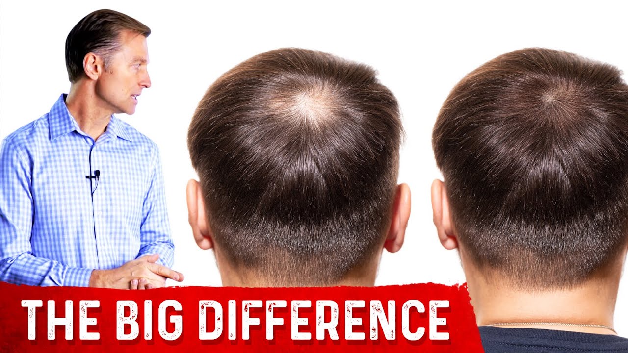 image Normal hair loss versus abnormal hair loss