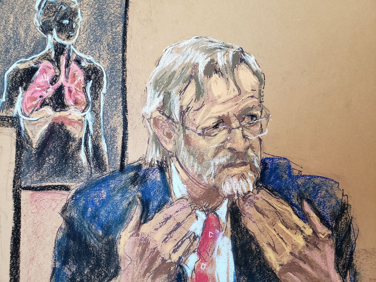 image Lack of oxygen from police restraint killed Floyd, doctor testifies at Chauvin murder trial
