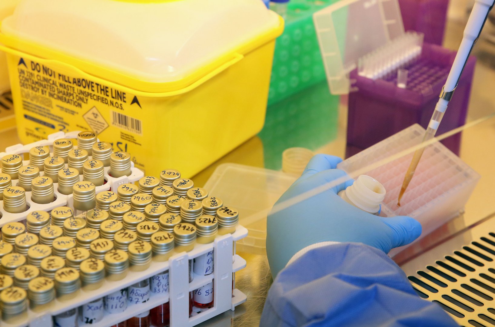 image Coronavirus: Police investigating alleged fraud in rapid test tender