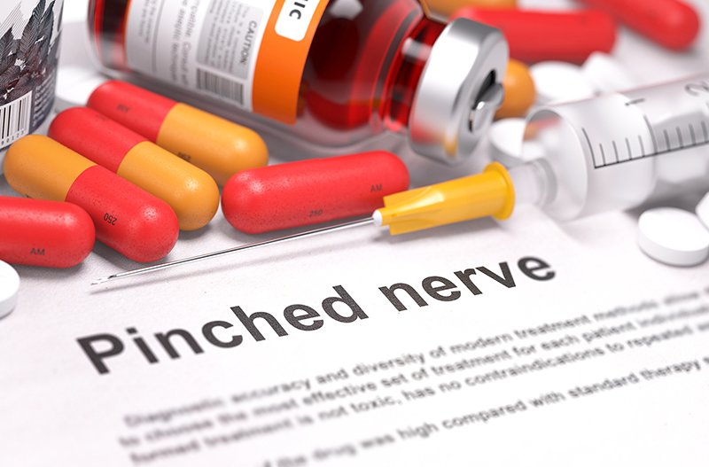 image Trapped nerves giving you grief?