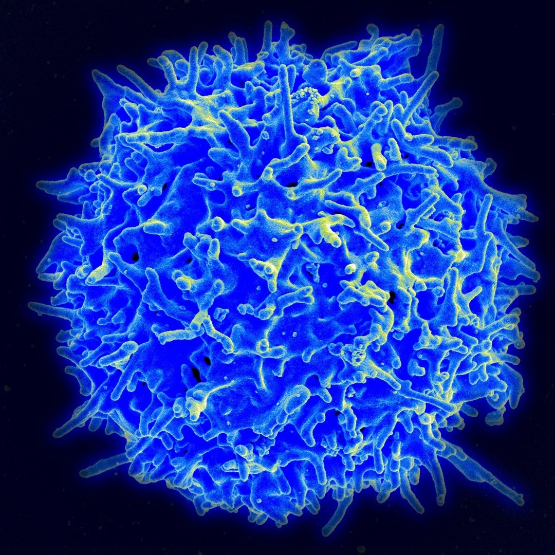 image Covid-19 severe or mild case? Portuguese researchers have discovered why?