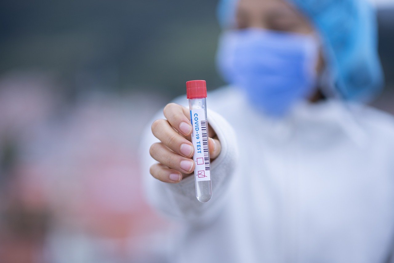 image Researchers announce 10-minute PCR Covid-19 test is accurate