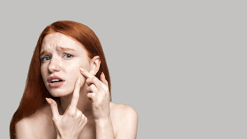image Dr Pimple Popper’s acne dos and don’ts