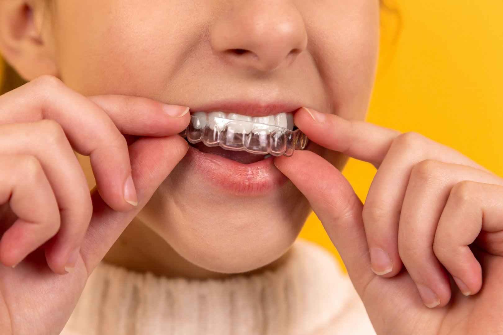 image Pandemic induced disruption: Dental industry sees rising alternatives to invisalign