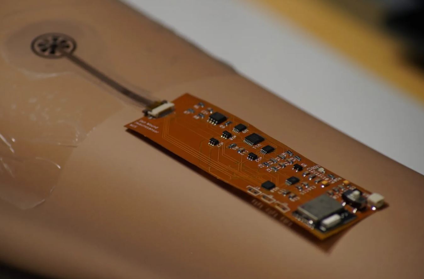 image Singapore tests out ‘smart bandage’ for remote recovery