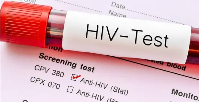 image Over 5,000 checked for HIV in the last ten years