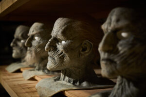 the prosthetics department