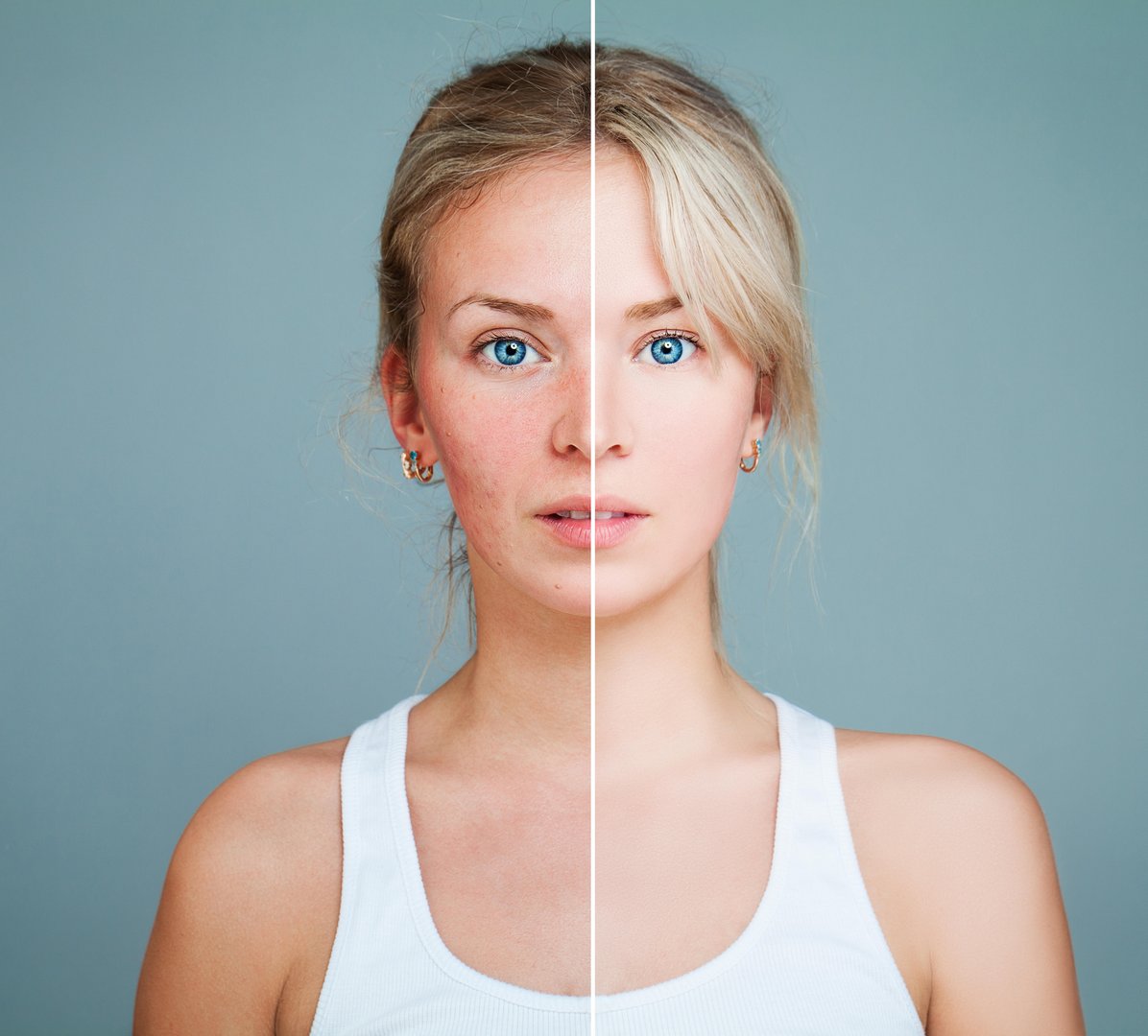 image Anti-inflammatory skincare: the latest soothing trend to help ease redness
