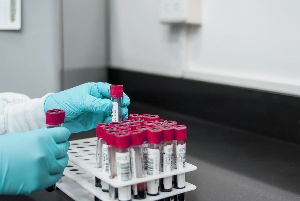 image Call for drug addicts to have better access to HIV and hepatitis tests