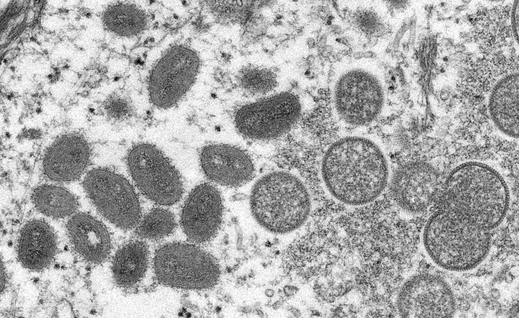 image WHO says monkeypox &#8216;containable&#8217; as more govts start limited vaccinations