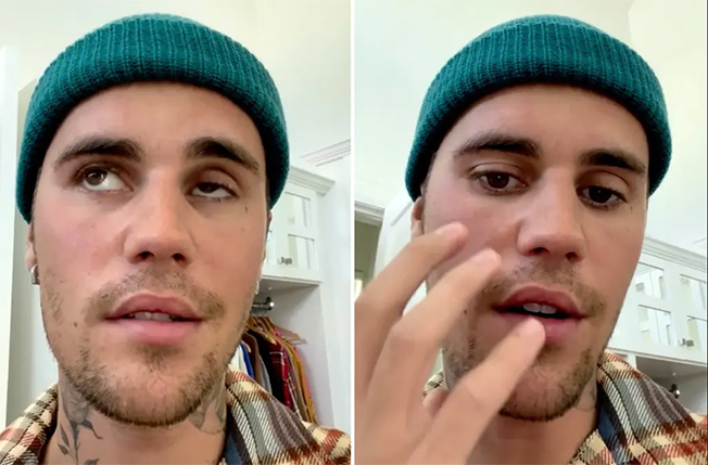 image Bieber is showing early signs of recovery, surgeon says