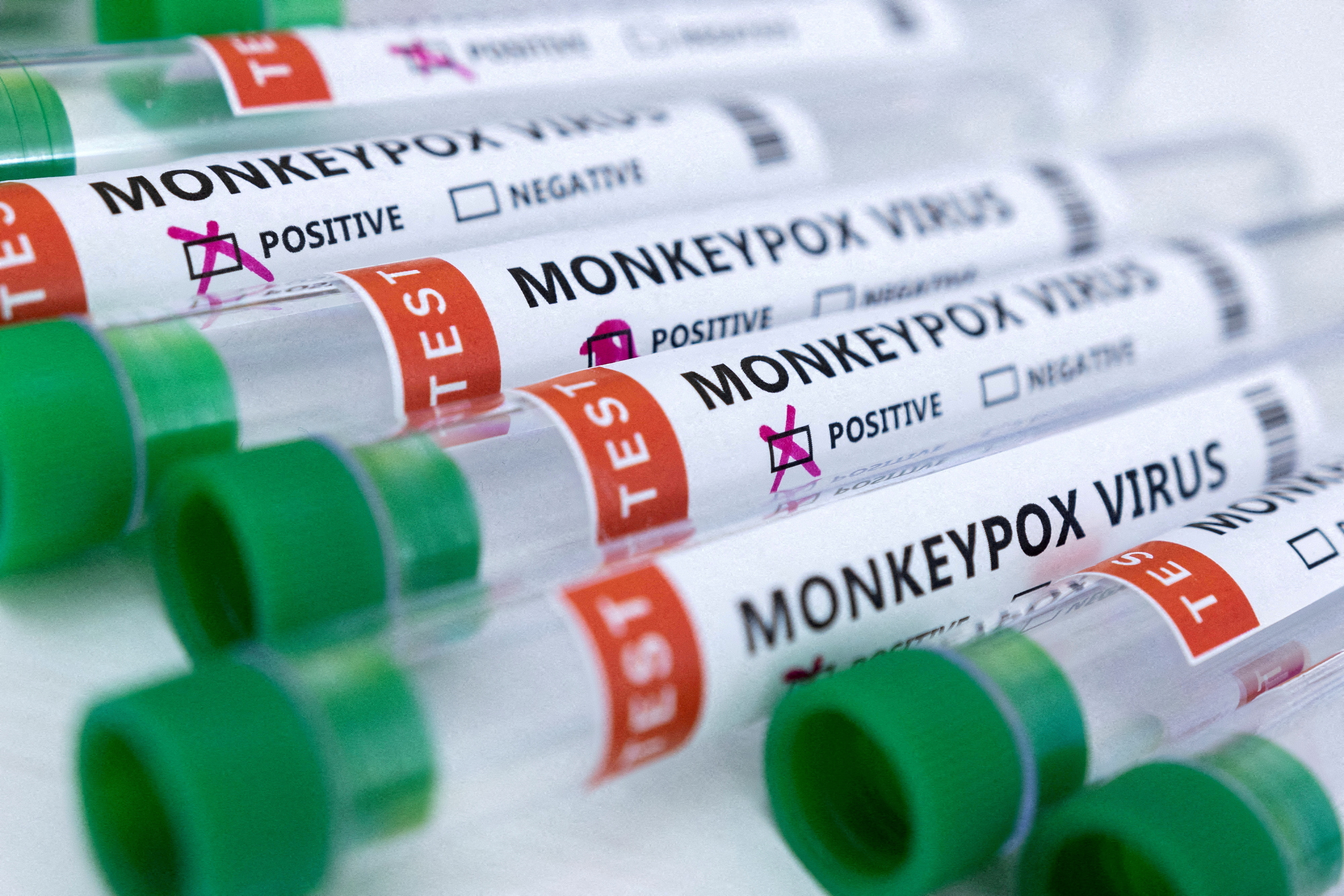 image Spain reports second monkeypox-related death in Europe