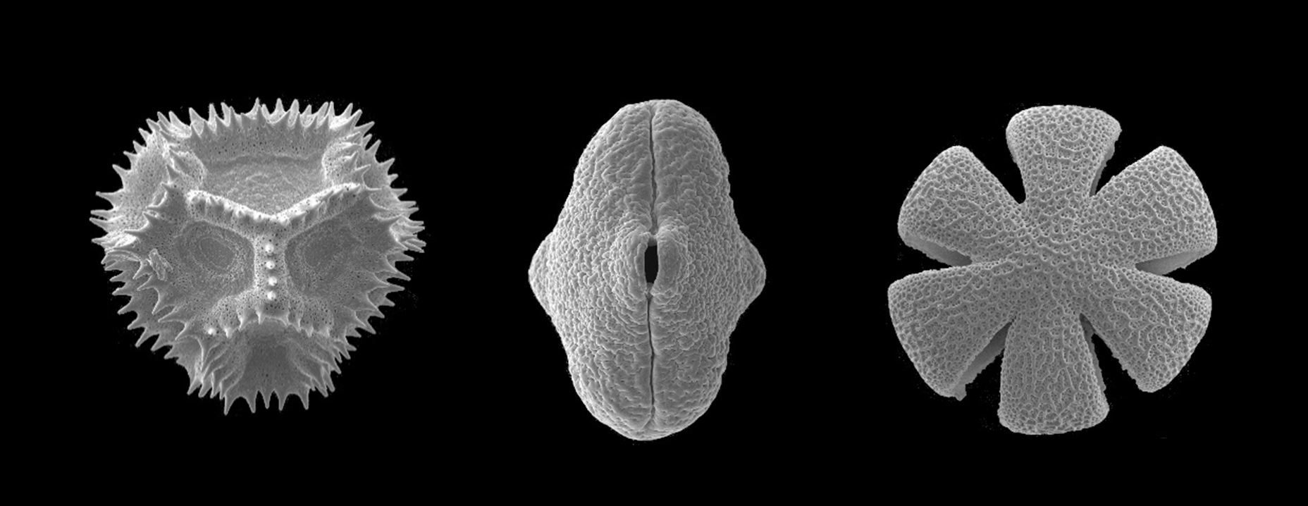 figure pollen grains (electron microscopy)