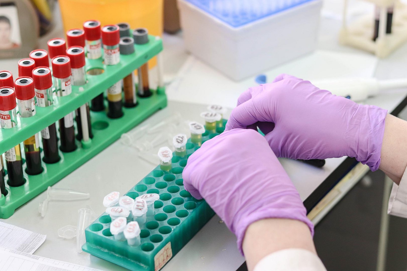 image UCy researchers find new strain of HIV-1