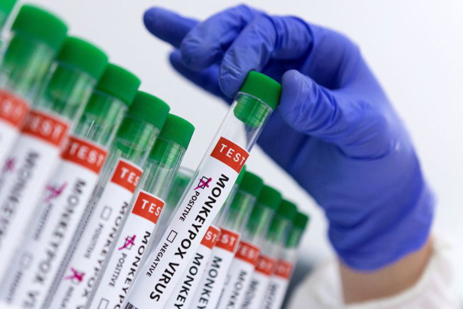 image India reports case of mpox in traveller from affected country