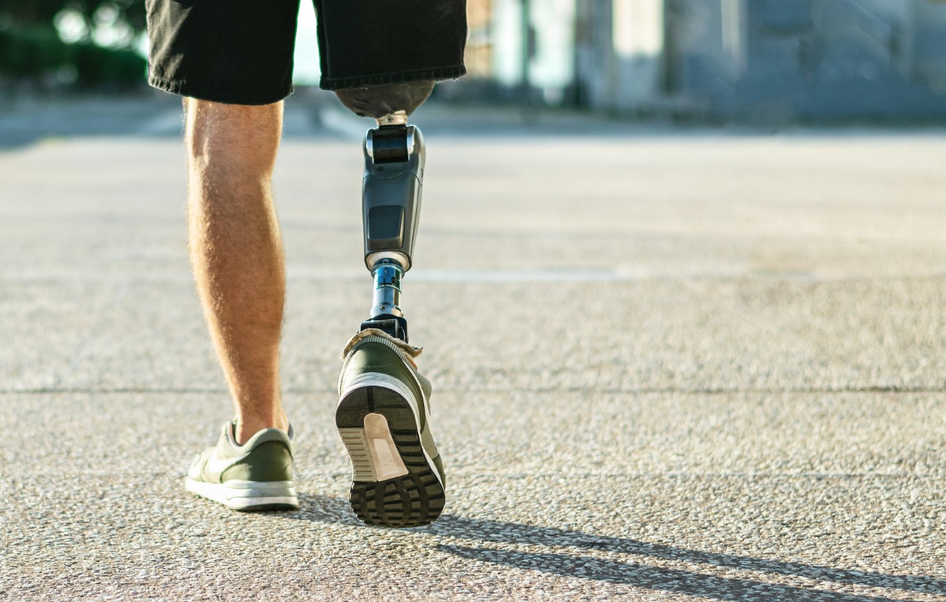 image Helping the body and brain to welcome bionic limbs and implants