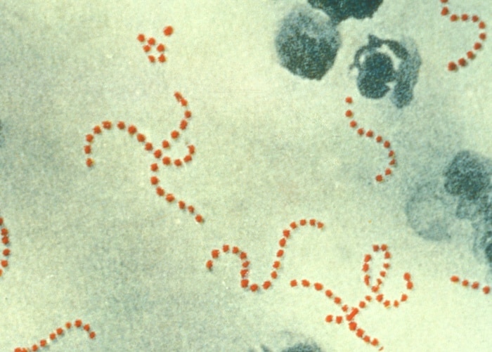 image Health ministry issues Strep A advice after rise in EU cases