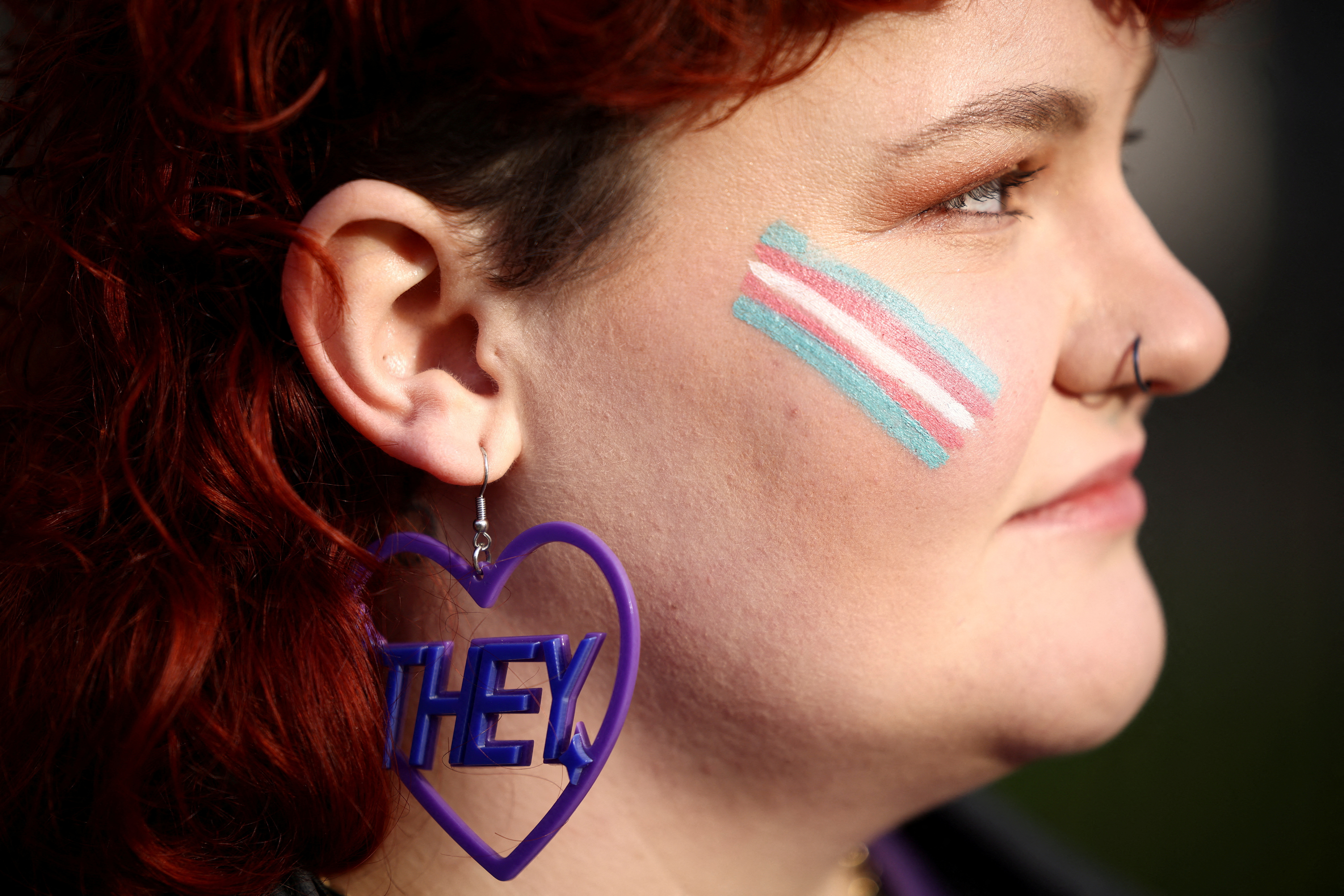 image Trans advocates in Russia brace for proposed gender surgery ban