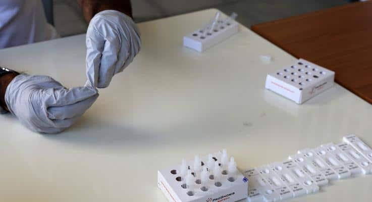 image Cyprus detects first cases of &#8216;Eris&#8217; Covid-19 sub-variant