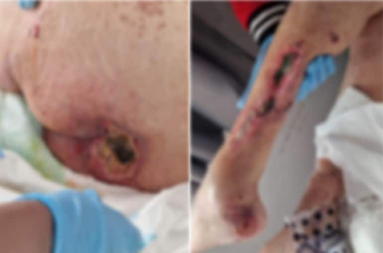image Doctor publishes further photo, accuses hospitals of negligence