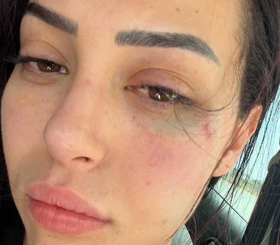 image Defence files not guilty plea over TC woman’s Ayia Napa beating trial (updated)