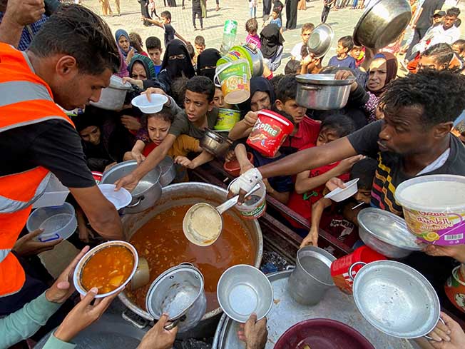 image Gaza displaced show signs of disease from crowding, poor sanitation