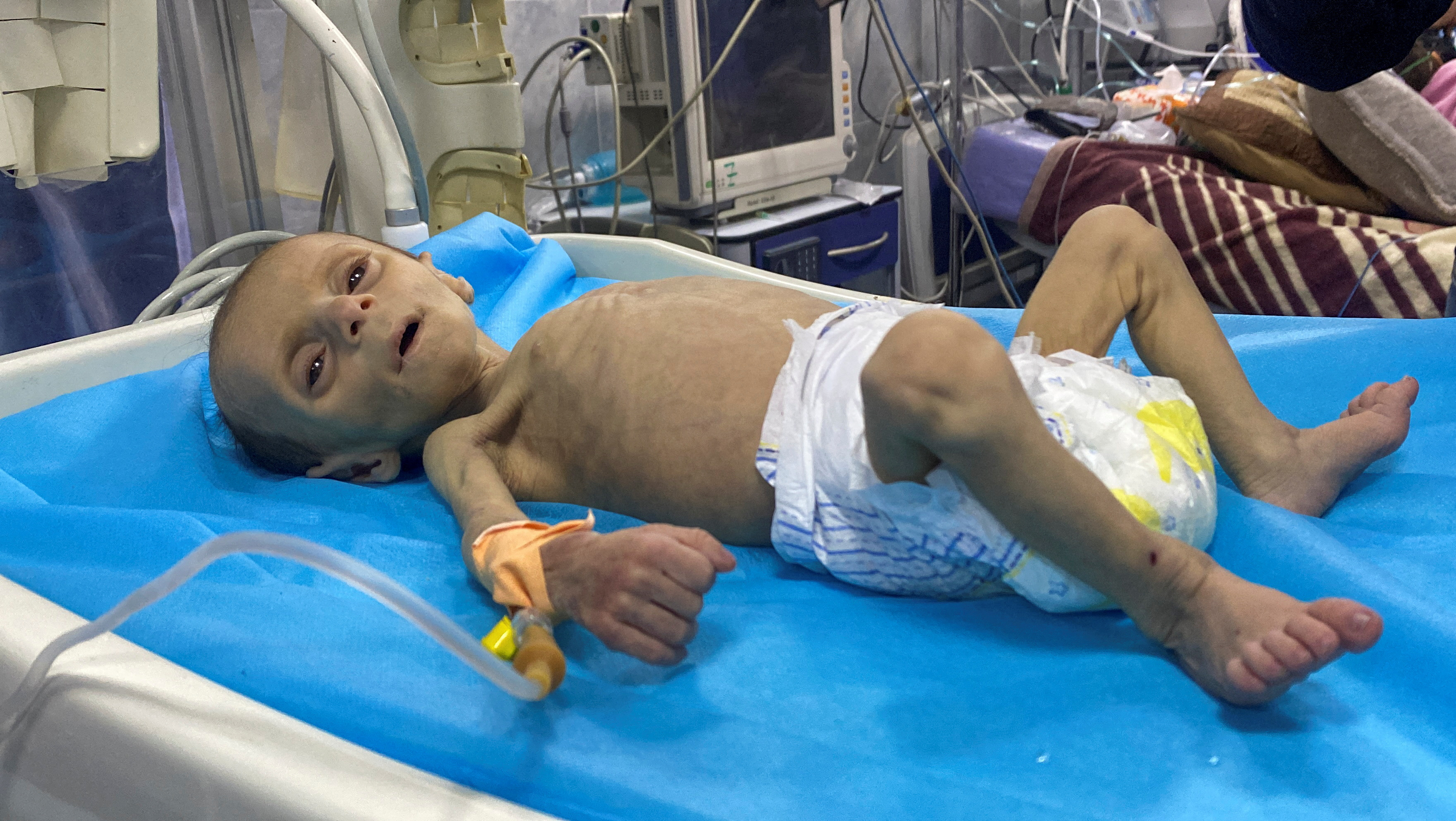 image World Court orders Israel to halt Gaza famine; Hamas says ceasefire needed