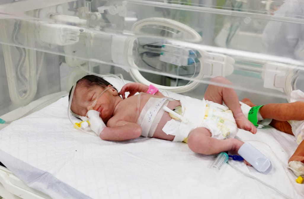 image Gaza baby saved from dead mother&#8217;s womb dies