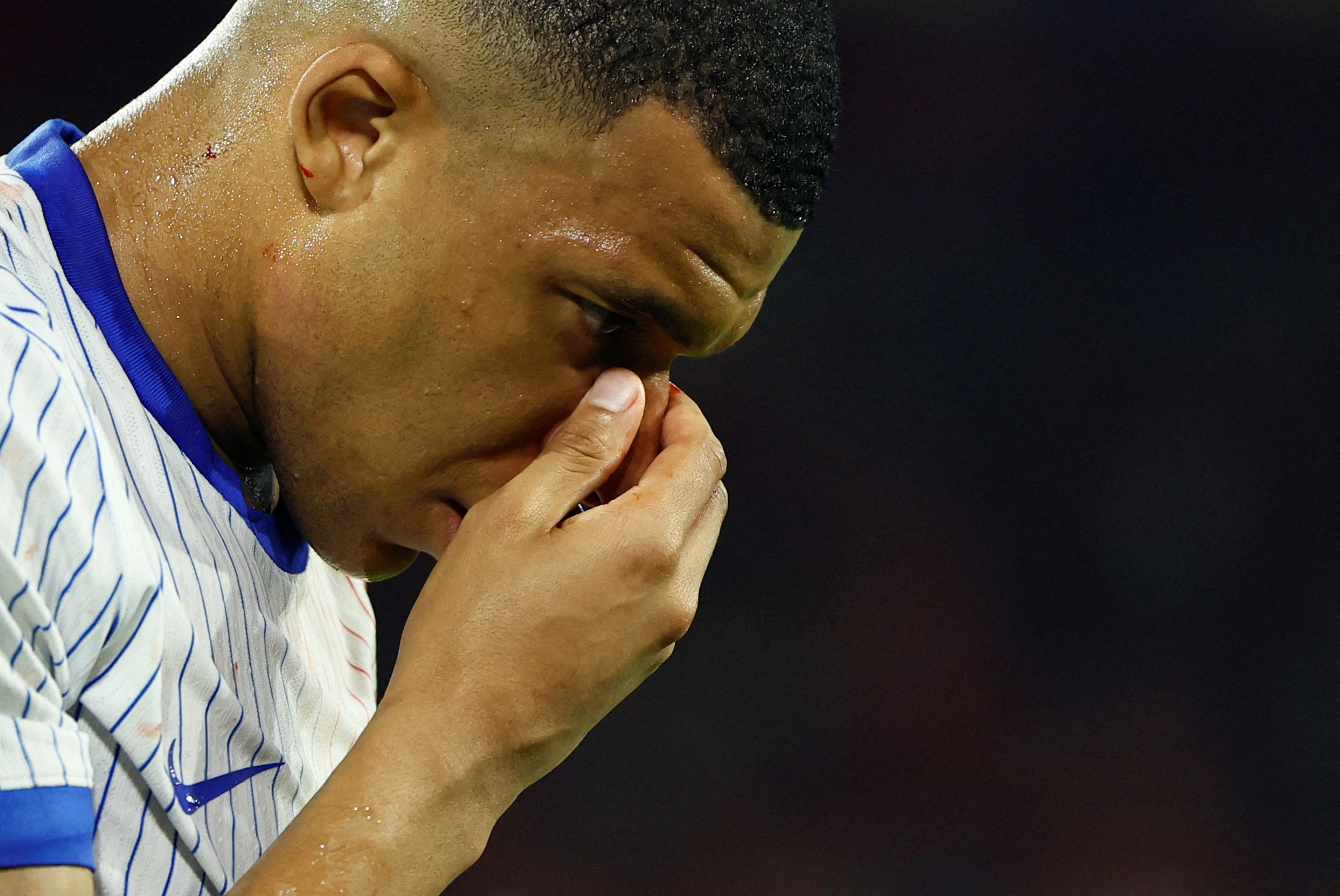 image France battle past Austria but Mbappe suffers broken nose