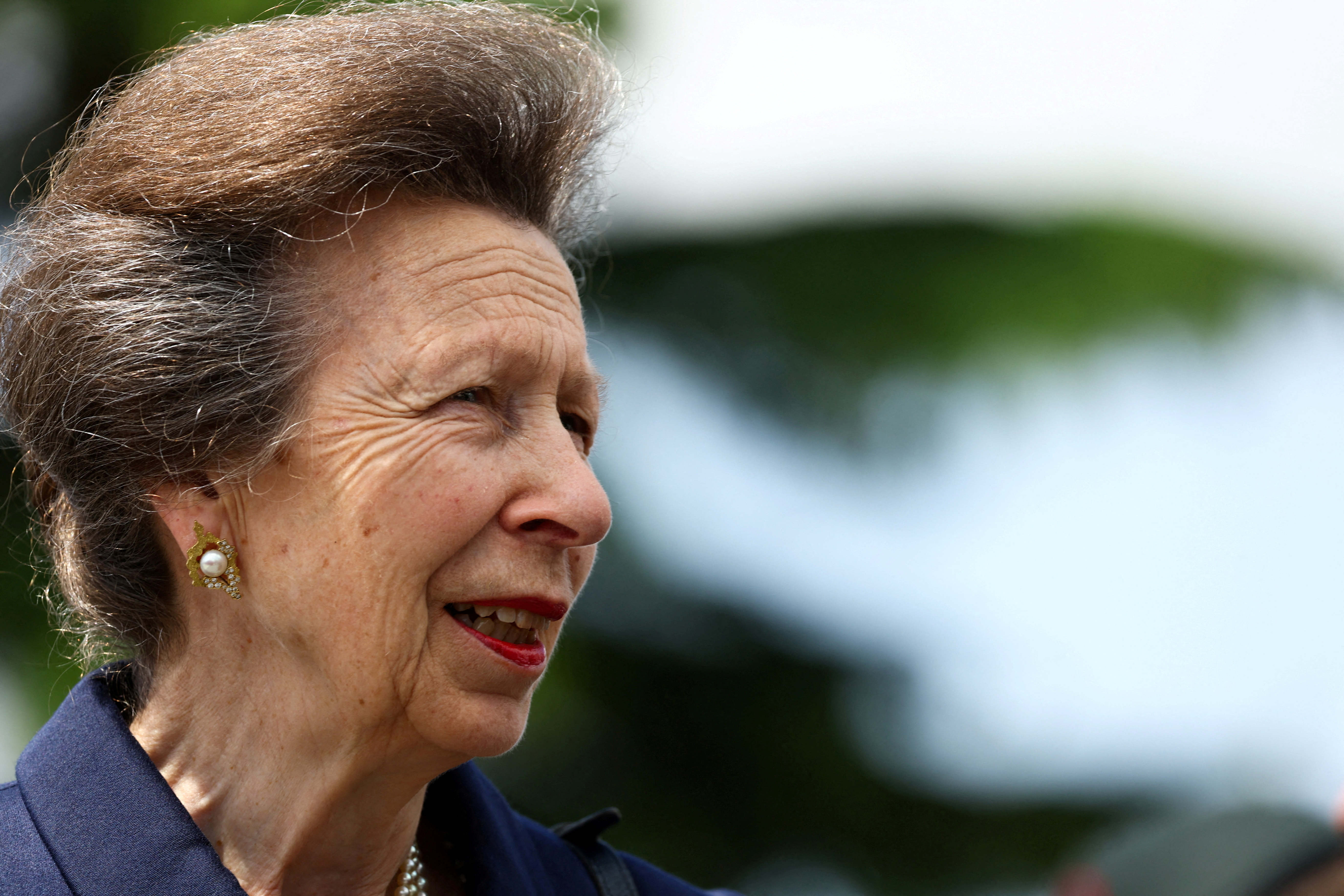 image Britain’s Princess Anne returns to royal duties after concussion