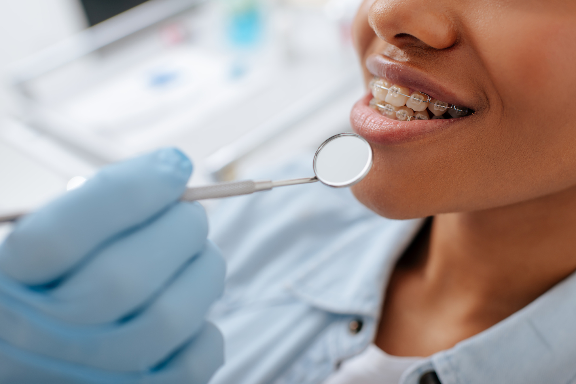 image SecureDental PPO Plans: Coverage, costs, and benefits explained