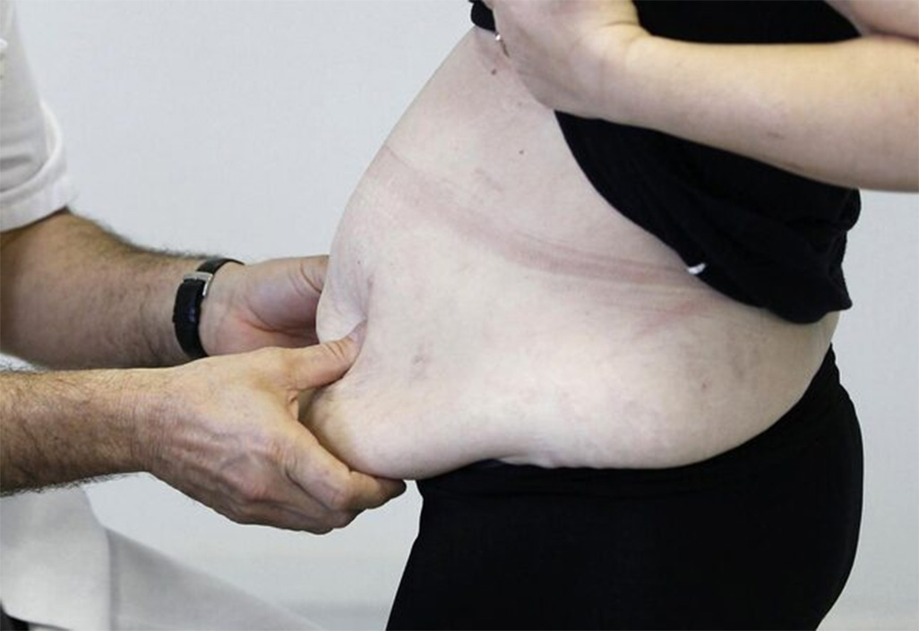 image Britain to study use of weight loss drug to get people back to work
