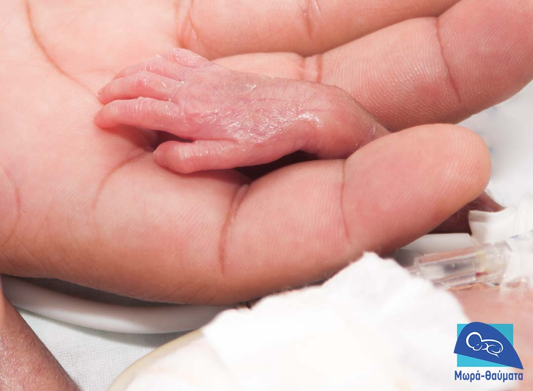 image Miracle Babies association celebrates 10th anniversary