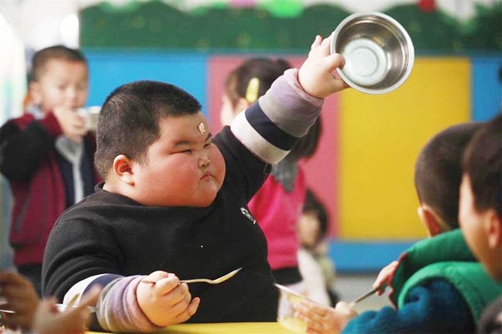 image Obesity rates soaring globally in &#8216;monumental social failure&#8217;