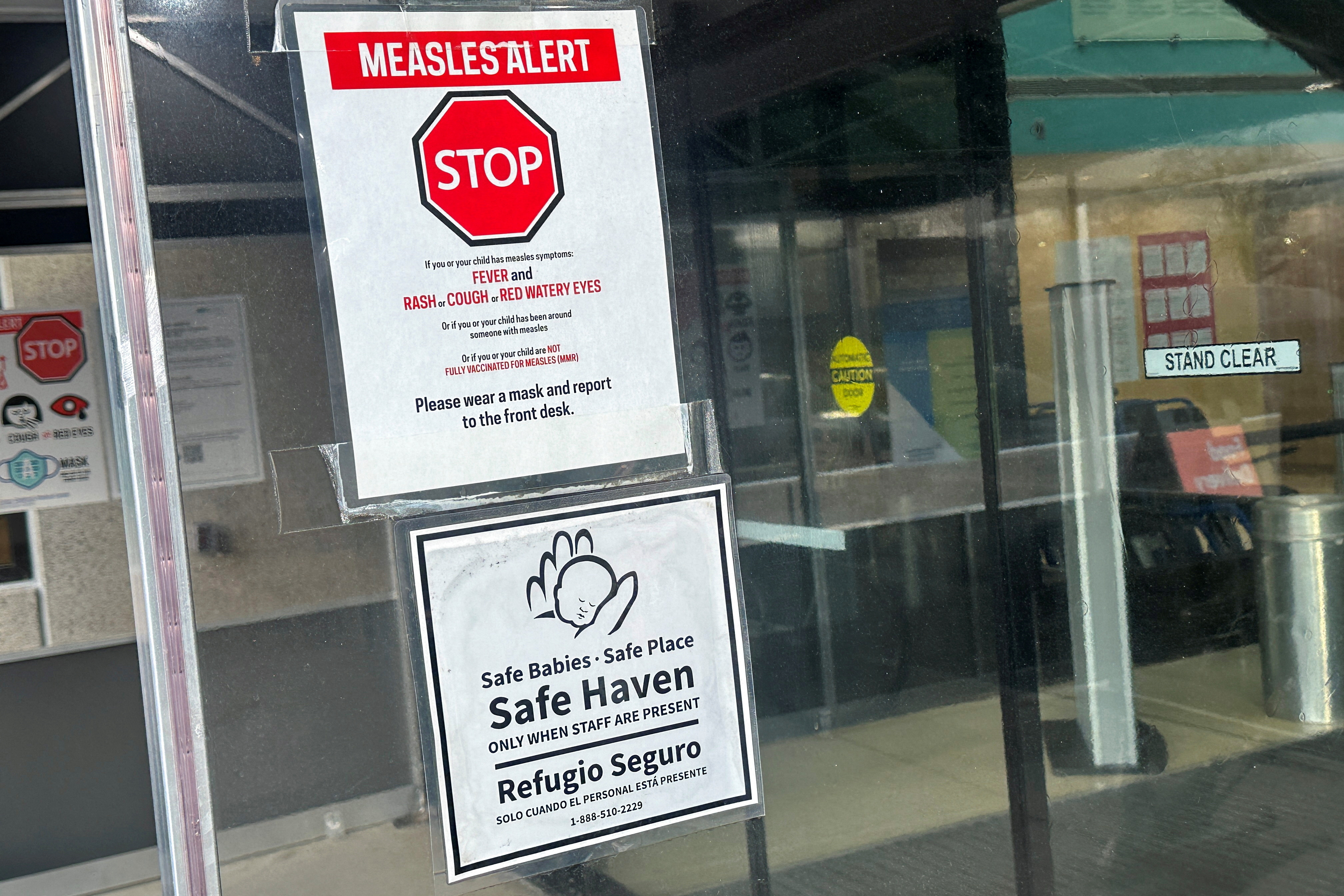image Measles cases surge in 2025, raising fears of widespread outbreak