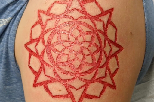 cover Freeze branding: the new body modification technique causes serious and irreversible harm