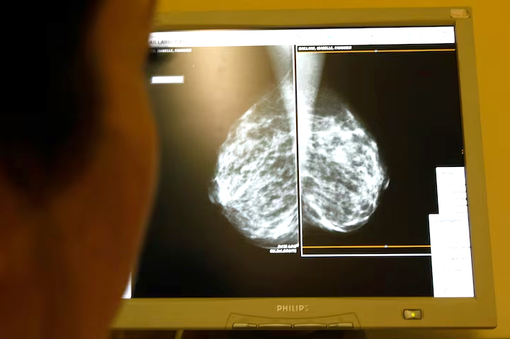 cover Cyprus-led team makes breast, ovarian cancer breakthrough