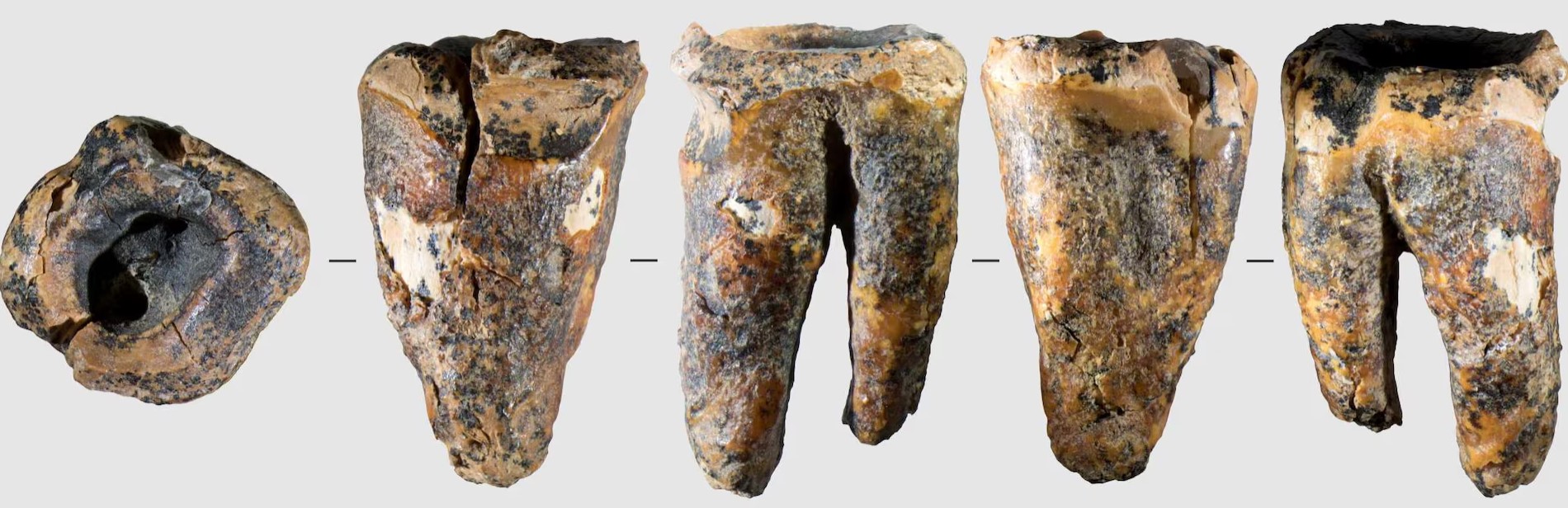cover Tooth from Siberian cave reveals Neanderthal dental surgery