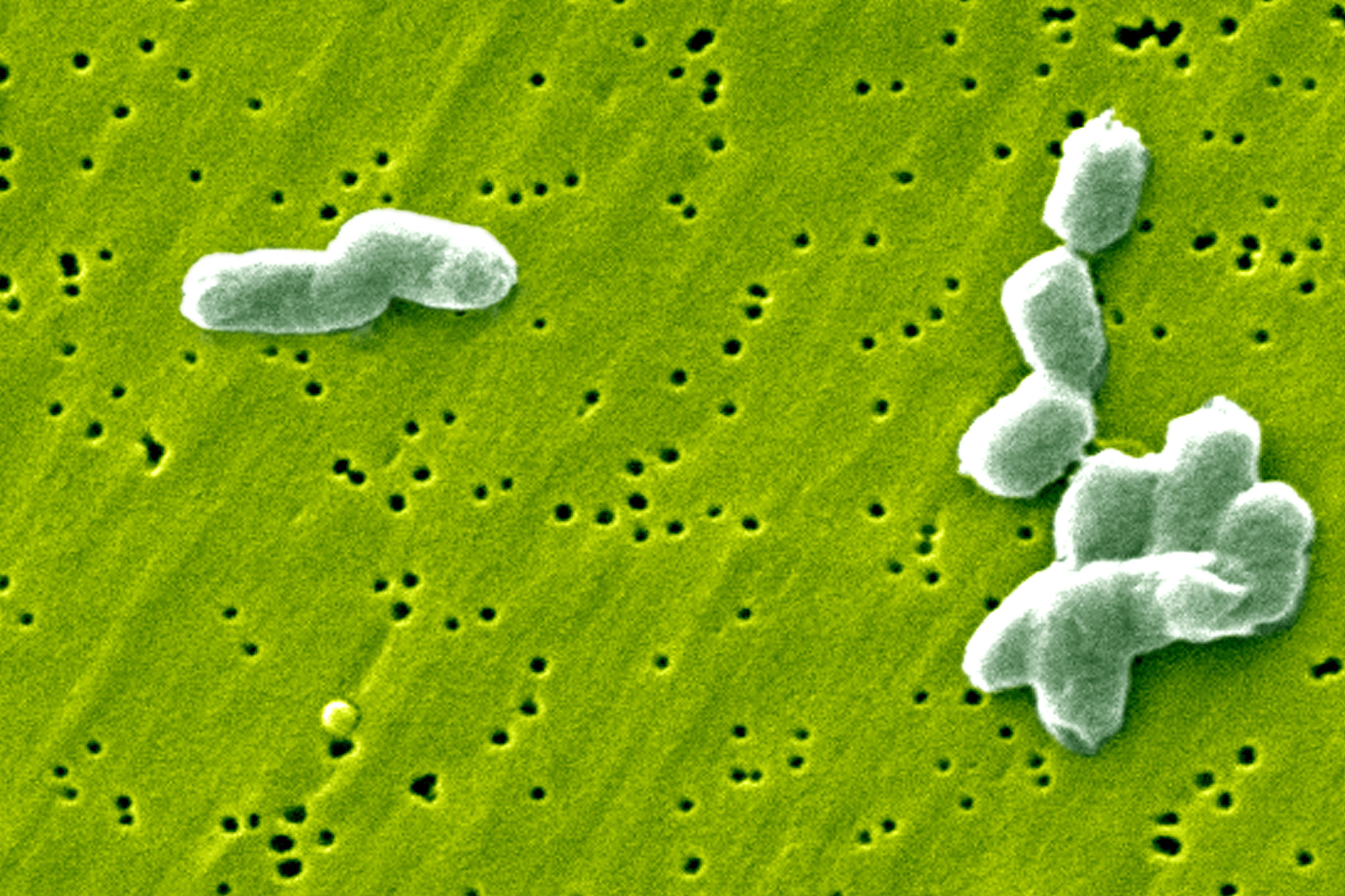 cover Record salmonella outbreak in Belgium infects at least 306