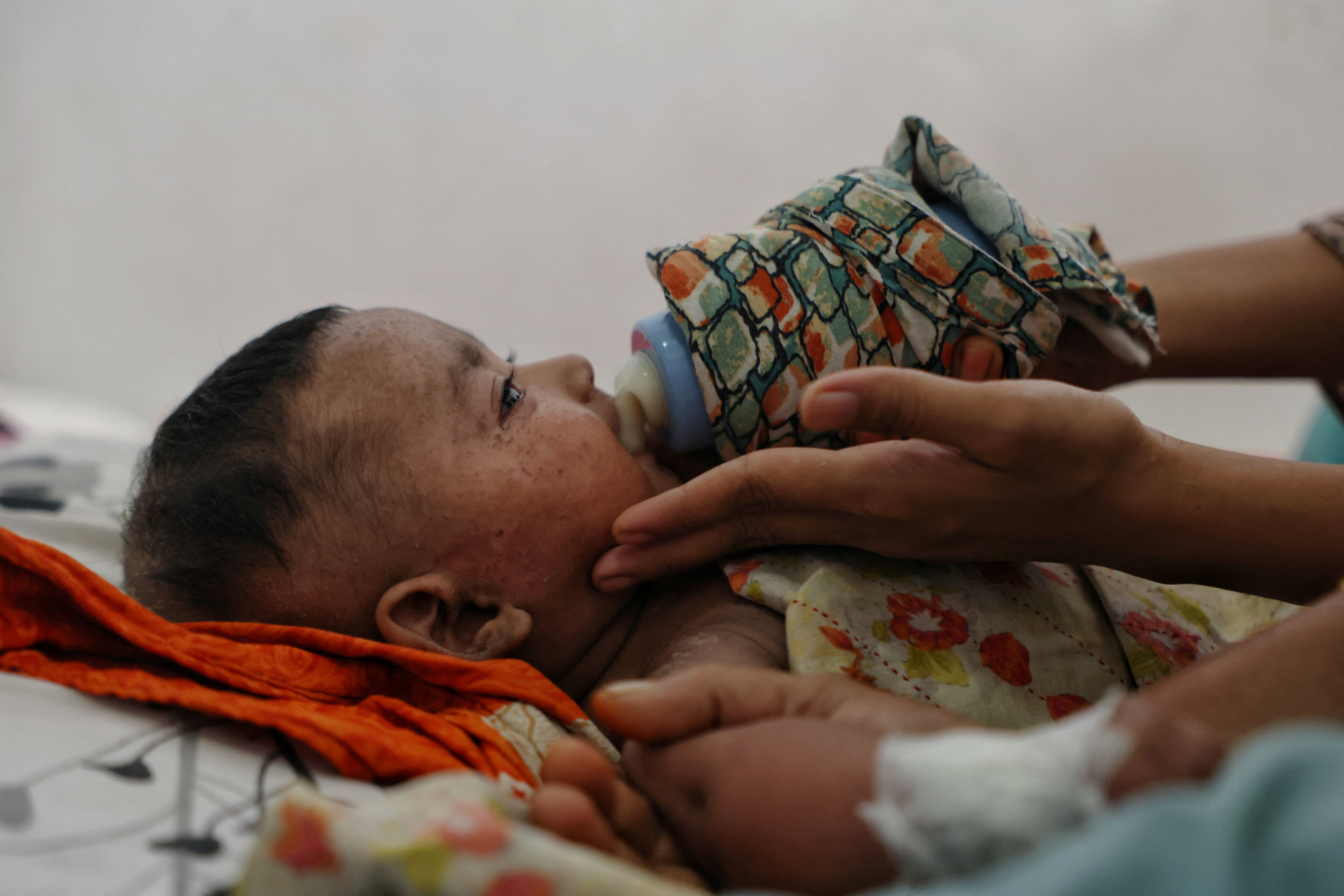 image Gates says vaccine hesitancy has put measles eradication out of reach
